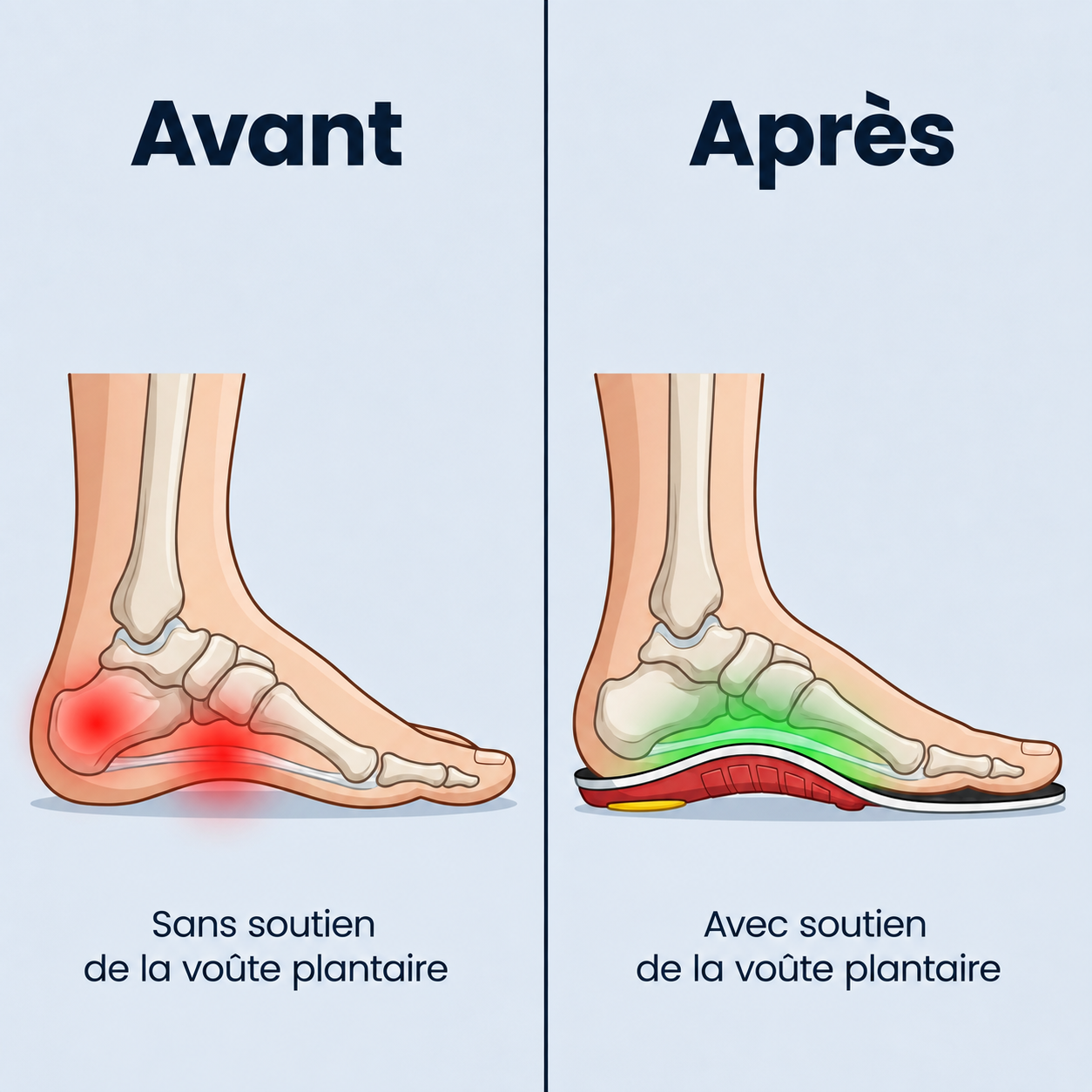 FlexiVoûte - Marchez sans douleur, du matin au soir