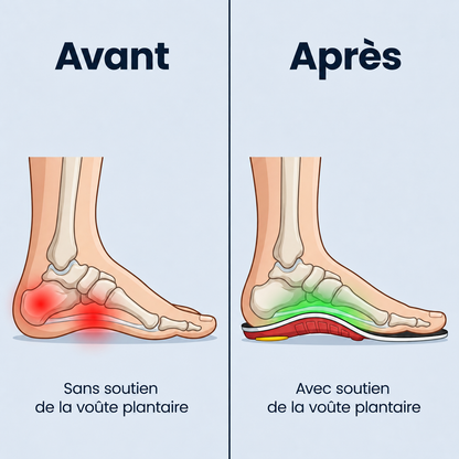 FlexiVoûte - Marchez sans douleur, du matin au soir