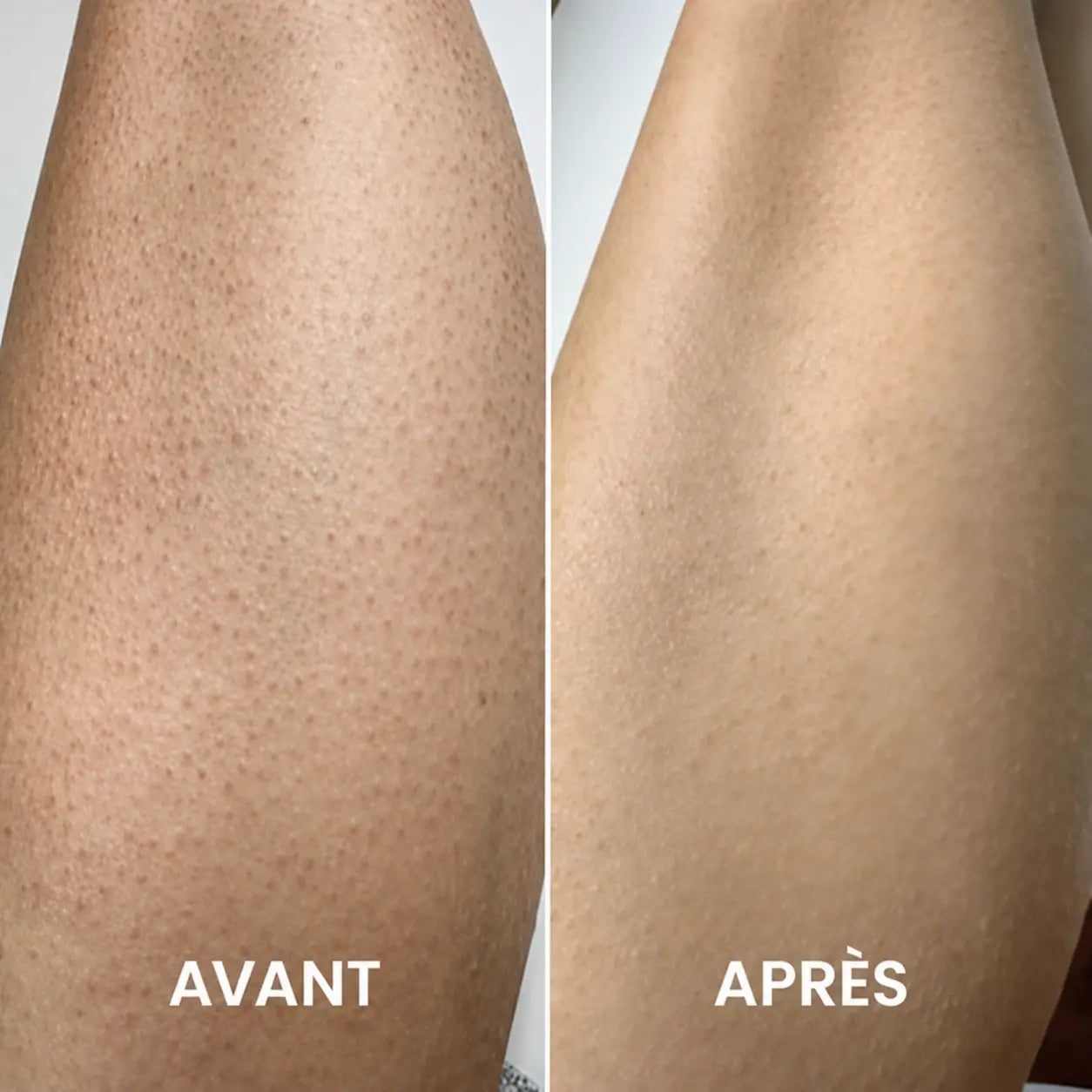 Gant exfoliant peeling