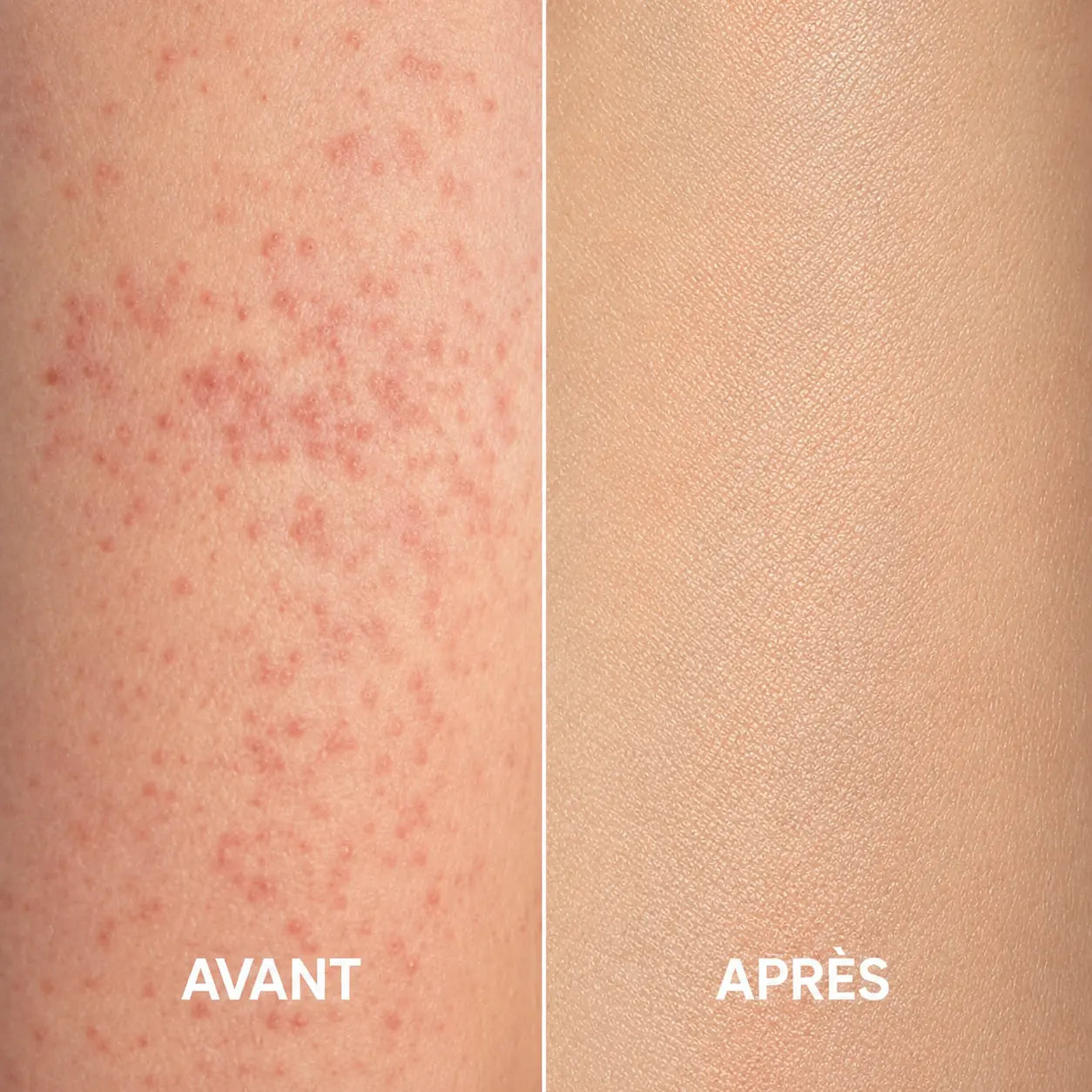 Gant exfoliant peeling